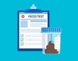 fecalysis|Fecalysis (Stool Exam) .